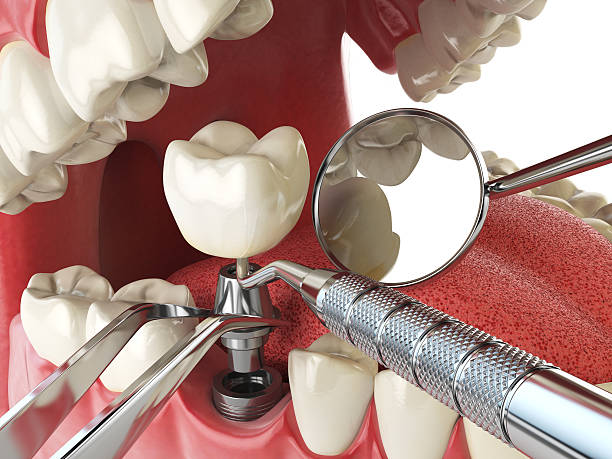 Best Emergency Care for Gum Disease in Dewitt, AR